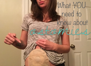 what you need to know about ostomies advice tips tricks stephanie hughes out of the bag colostomy ileostomy crohn's disease ulcerative colitis inflammatory bowel disease ibd ostomy blog stolen colon ileostomy colostomy urostomy