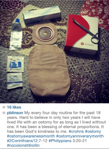 Philip Blinson crohn's story OstoMYstory stoma ostomy crohn's disease ulcerative colitis ileostomy colostomy urostomy inflammatory bowel disease ibd stolen colon