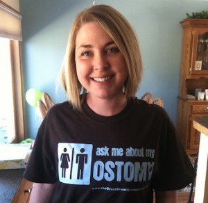 Lindsey Russell colostomy jpouch crohn's story OstoMYstory stoma ostomy crohn's disease ulcerative colitis ileostomy colostomy urostomy inflammatory bowel disease ibd stolen colon