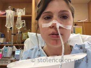ng tube crohns