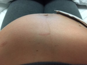 preggo belly