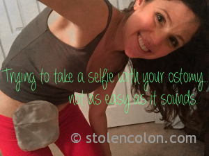 ostomy selfie stephanie hughes stolen colon crohn's disease inflammatory bowel disease